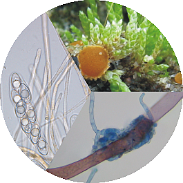 Apothecium, infectious hyphae and ascus with spores of Octospora leucoloma